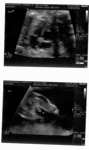 Picture of Heart and the Sex Organs