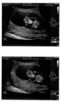 Baby Solomon-Strutz - July 30, 2007