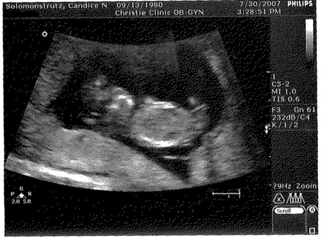 Baby Solomon-Strutz - July 30, 2007