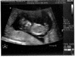 Baby Solomon-Strutz - July 30, 2007